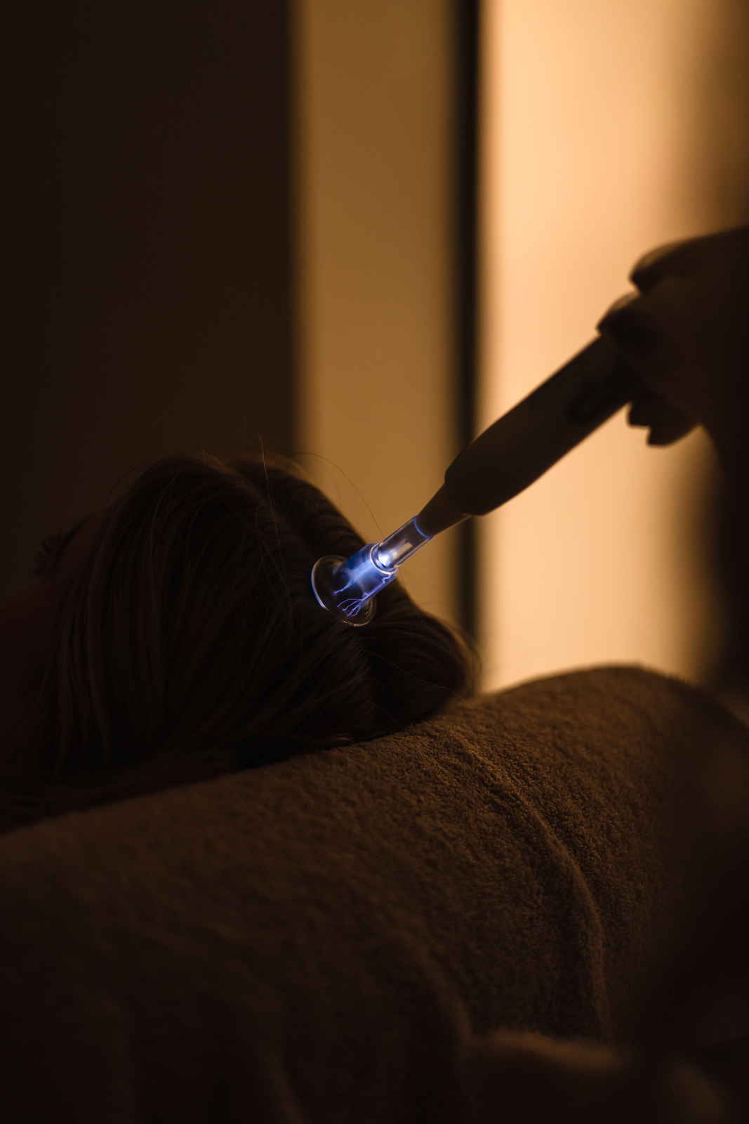 Fusion plasma haarverlies