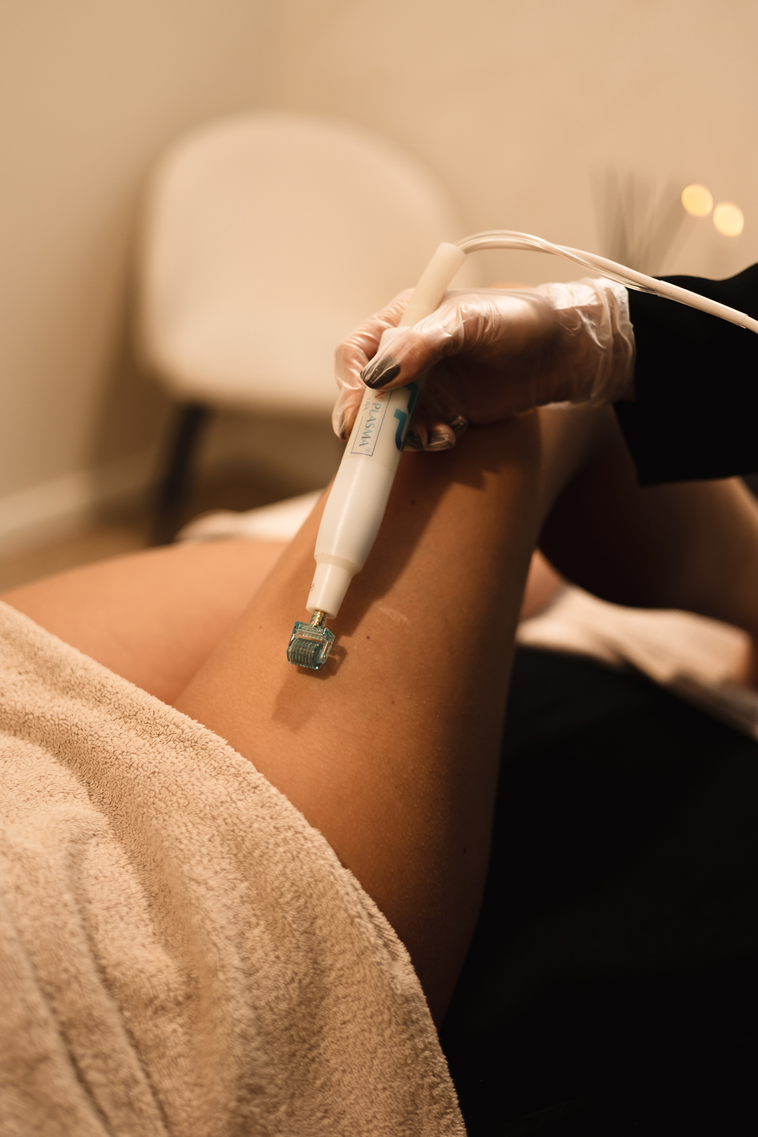 Fusion plasma striae